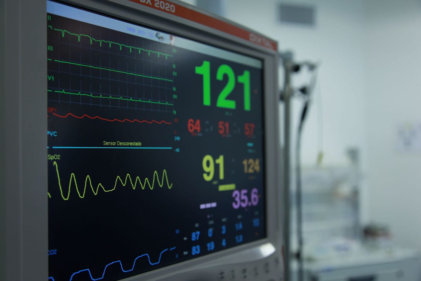 A bedside vital signs monitor displaying numeric readings and waveform traces in a clinical setting.